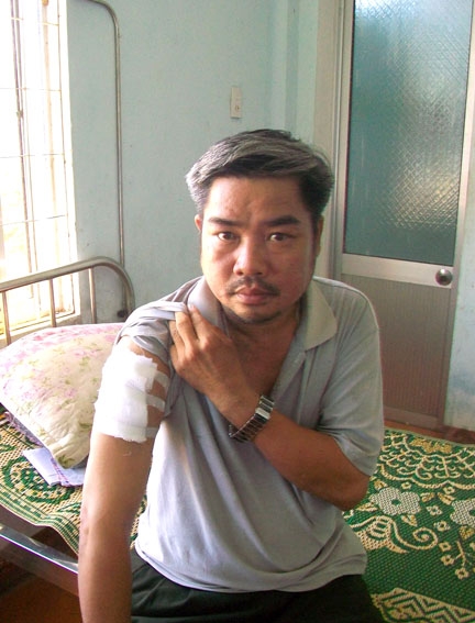 Ông Kịp- Trưởng C.A xã Hành Thuận với vết thương ở tay phải
