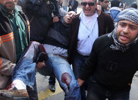 Một người biểu tình Ai Cập bị thương được những người bạn đưa đi. Ảnh: AFP