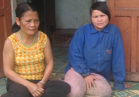 Chị Đinh Thị Rào (bên phải) kể lại ký ức kinh hoàng hơn 2 năm về trước.