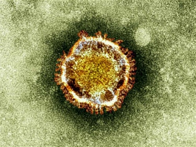 Hình ảnh một Coronavirrus trên kính hiển vi điện tử được cho là thủ phạm giết sáu người trên thế giới. Ảnh: AP.