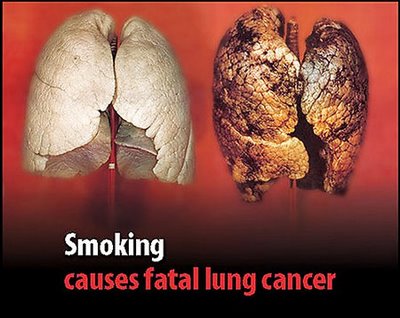     Thuốc là là nguyên nhân gây ung thư phổi.