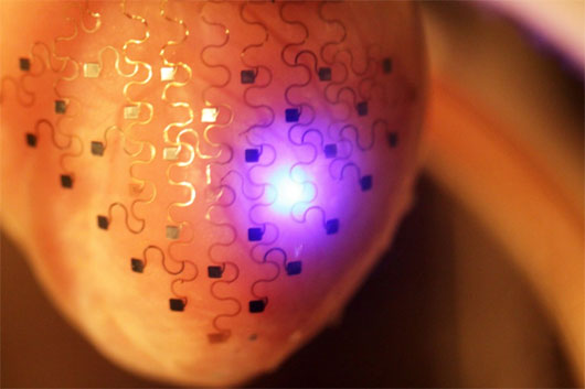 Vỏ điện tử trên phiên bản 3D của tim thỏ - (Ảnh: Rogers Research Group)