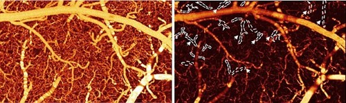  Trong ảnh bên trái, người xem thấy các mạch máu của chuột khi cocaine chưa xâm nhập cơ thể chúng. Nhưng trong ảnh bên phải, những mạch máu trở nên thẫm hơn sau khi cocaine xâm nhập cơ thể chuột. Mức độ thẫm càng lớn thì máu di chuyển càng chậm. Ảnh: Daily Mail