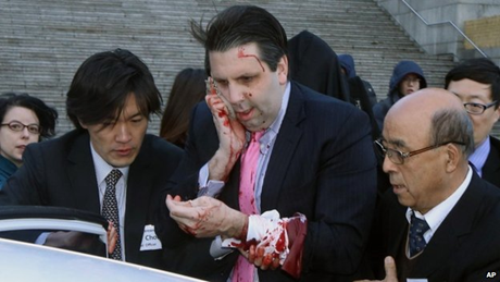 Đại sứ Mỹ tại Hàn Quốc bị thương ở dầu và tay phải. (Ảnh: AP)