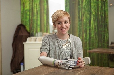 Nicky Ashwell với bàn tay robot mới. Ảnh: roboticstrends