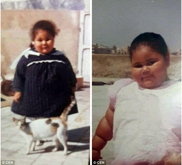  Abdulati rất mập từ khi còn là một đứa trẻ