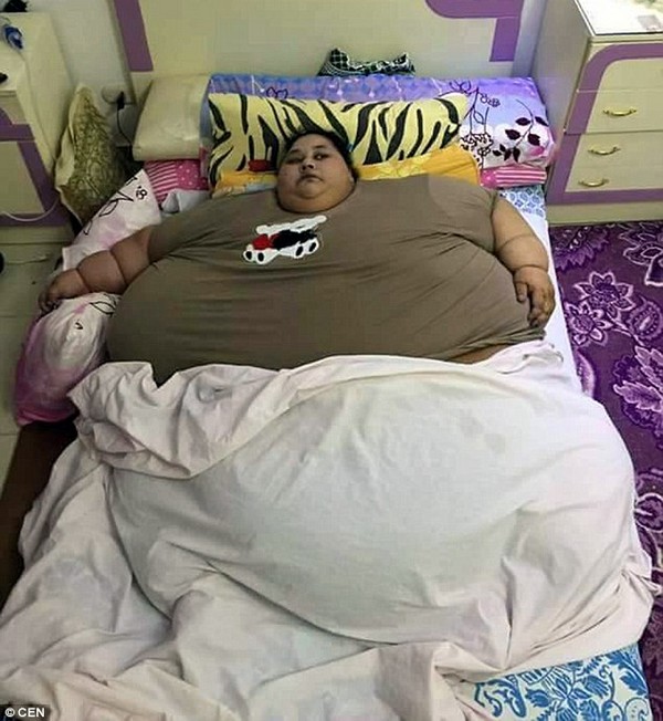 Iman Ahmad Abdulati là người phụ nữ mập nhất thế giới với cân nặng lên đến 500kg