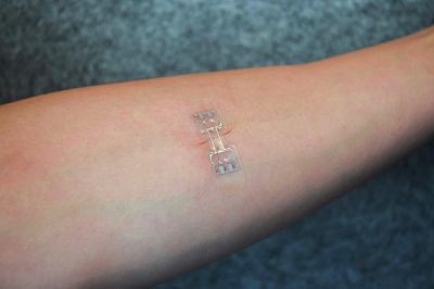 MicroMend sử dụng chất keo dính để giữ vết thương bịt kín - Ảnh: KitoTech Medical