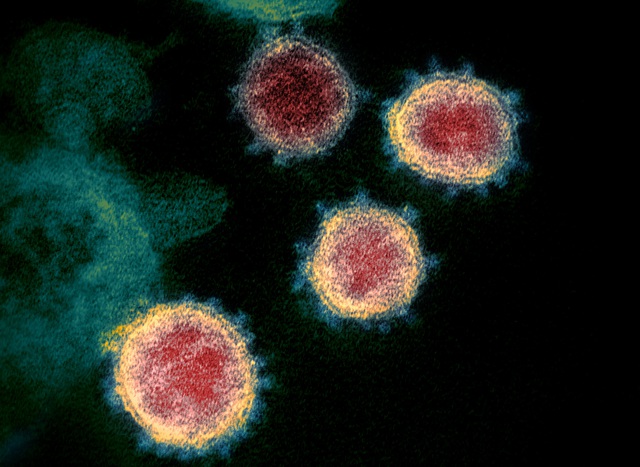Ảnh chụp virus SARS-CoV-2 tấn công vào một tế bào tại một cơ sở nghiên cứu ở Fort Detrick, Maryland, Mỹ. (Ảnh minh họa: Reuters)