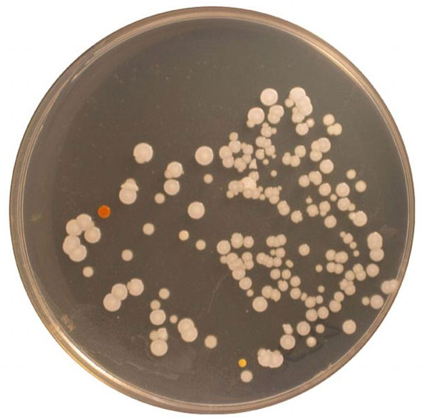 Giống như người, loài vi khuẩn có tên Micrococcus tồn tại trong rốn của chúng ta cũng cần oxy để sinh tồn. Chúng ít có khả năng sinh trưởng tốt ở sâu bên trong rốn, mà chỉ tập trung phát triển ở trên bề mặt. Chúng có thể đối phó với tình trạng khô hạn hoặc đói kém kéo dài và di cư tới sống bám trên những vùng da khô của người. (Ảnh: Daily Mail)