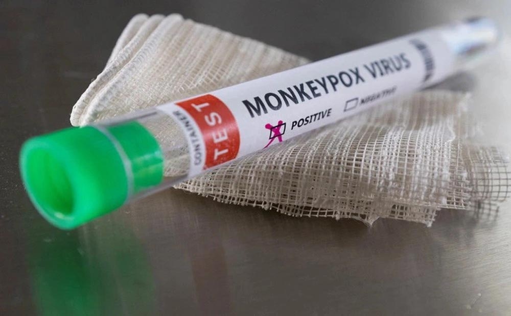 Phát hiện thêm 1 trường hợp mắc đậu mùa khỉ tại TP.Hồ Chí Minh