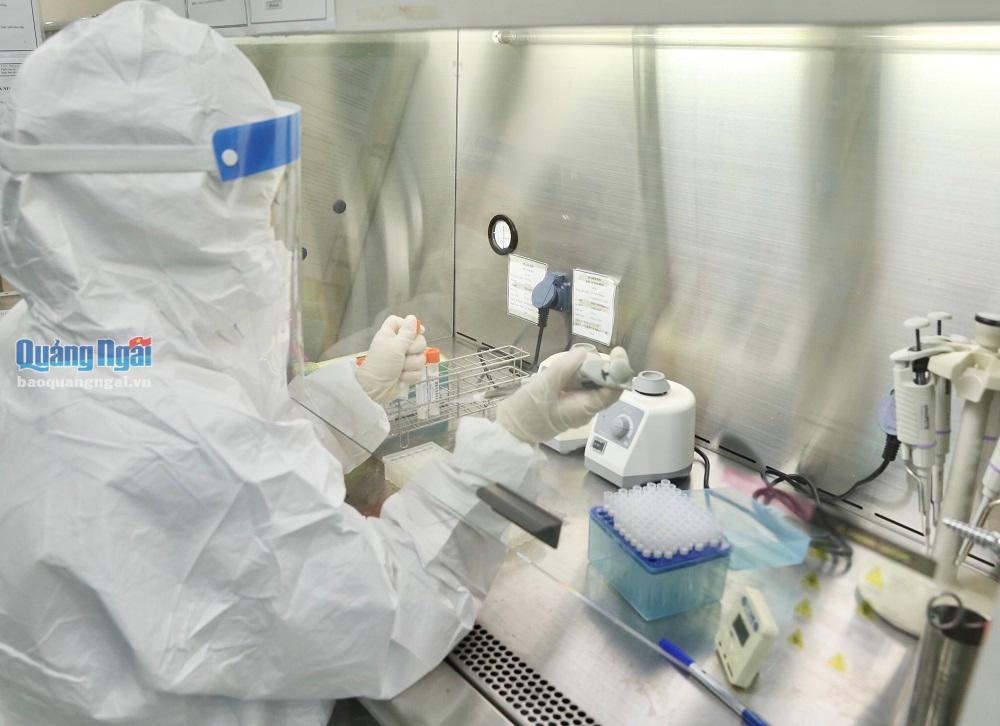 Xét nghiệm sàng lọc Covid-19 bằng phương pháp Realtime-PCR