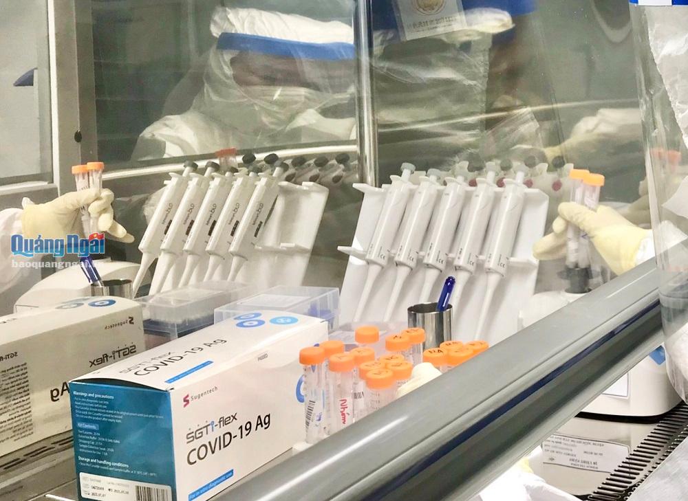 Các bộ kit và sinh hóa phẩm dùng trong xét nghiệm sàng lọc Covid-19